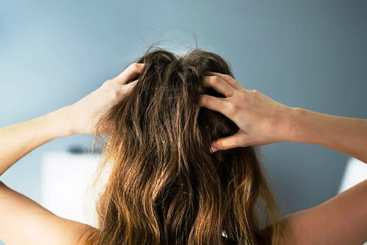 Ketombe Berminyak: Ciri, Penyebab, dan Dampaknya