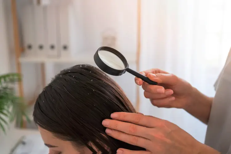 Rutinitas Perawatan Kulit Kepala Mingguan agar Ketombe Tidak Mudah Kambuh